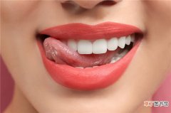 对牙齿有害的食物有哪些？牙齿保护好，才能吃嘛嘛香