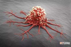 查出癌症等于判了“死刑”，4种癌可暂时不治