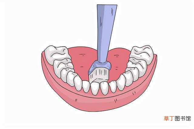 牙龈出血是什么原因导致的？
