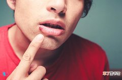 嘴唇疱疹最佳治疗方法，为什么会出现嘴唇疱疹?