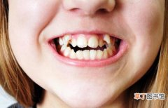人一般有多少颗牙齿 人有多少颗牙齿