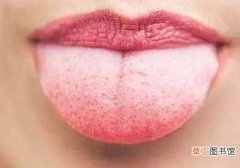 舌头发白是艾滋病吗