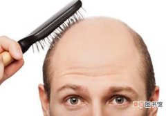 男性脱发是什么原因引起的 快来拯救你的头发