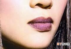 嘴唇发紫是什么原因 嘴唇发紫是为什么