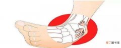 踝关节扭伤按摩手法 踝关节扭伤可以按摩么