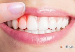 洗牙牙齿会变白吗 洗牙对牙齿有伤害吗