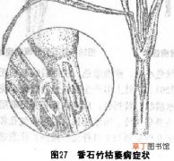 【香】如何防治香石竹枯萎病有哪些方法？