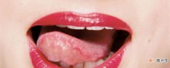 舌头咬破了伤口怎样能快速愈合 吃饭时牙齿咬舌头的原因