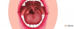 齿痕舌很严重是怎么回事 齿痕舌怎么调理才好