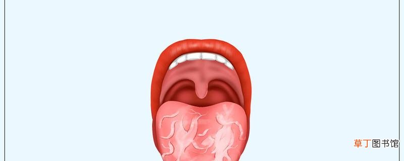 地图舌没有舌苔是怎么回事 地图舌不治疗会有影响吗
