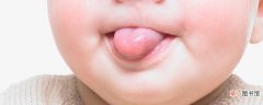 齿痕舌严重后果是什么 齿痕舌是湿气重还是脾胃虚弱